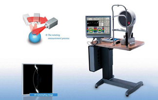 德国Oculus眼表分析系统