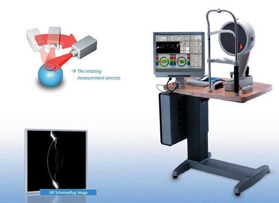 德国Oculus眼表分析系统.jpg